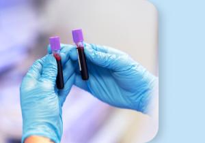 Dwie fiolki z krwią